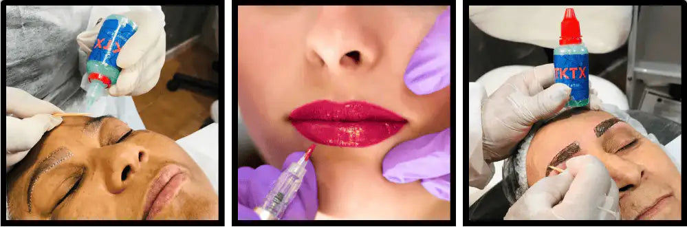 GEL TKTX 30 ml - Pack 5